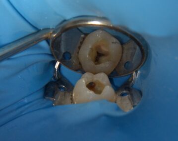 IMG_9943