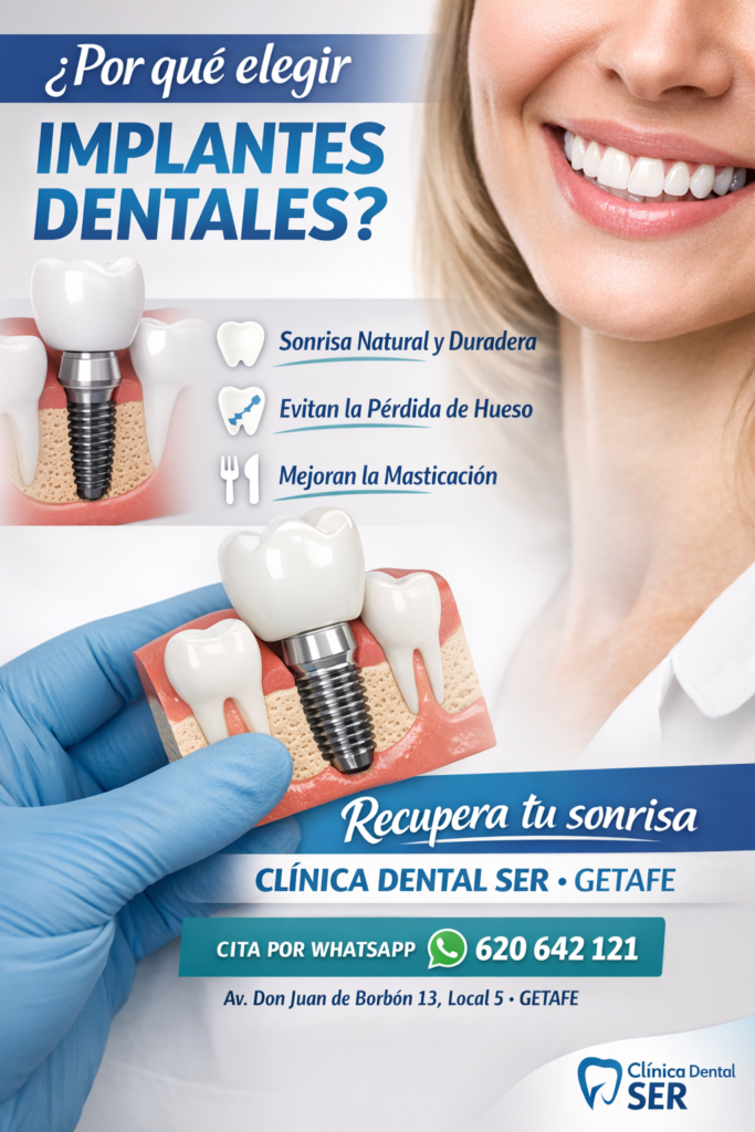 implantes dentales en Getafe Clínica Dental SER